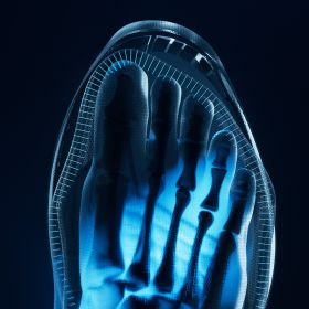 X-ray image, Fuß, Z toes, bläuliche Glut, medizinische Bildgebung